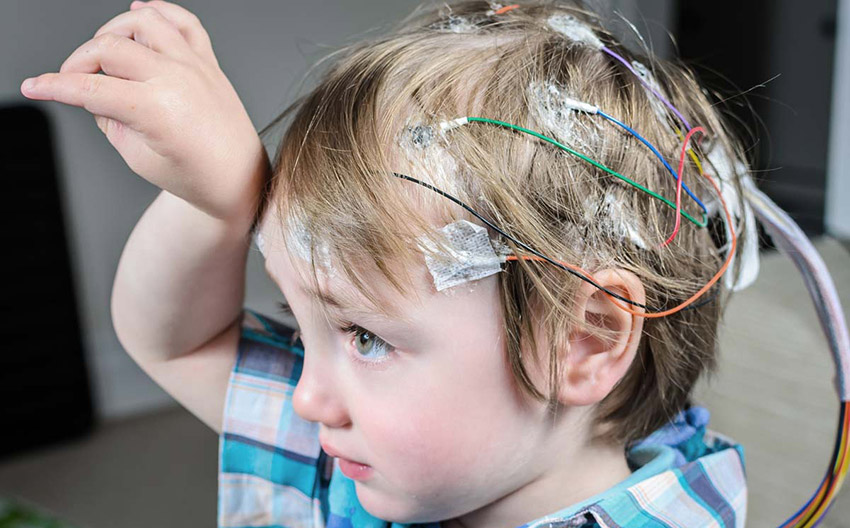 Bebeklerde Epilepsi Belirtileri ve Tedavisi