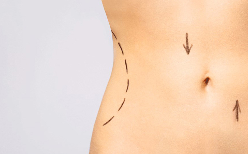 Doğum Sonrası Estetik Operasyonları