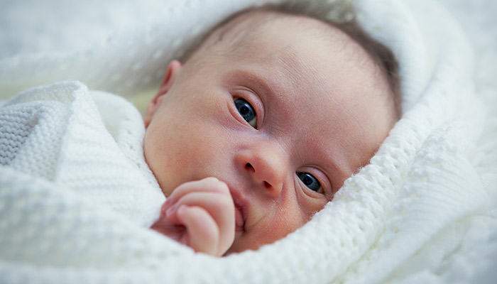 Edward Sendromu (Trizomi 18) Nedir?