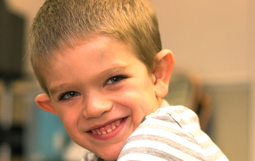 Frajil X Sendromu Hakkında Bilmen Gereken Her Şey!