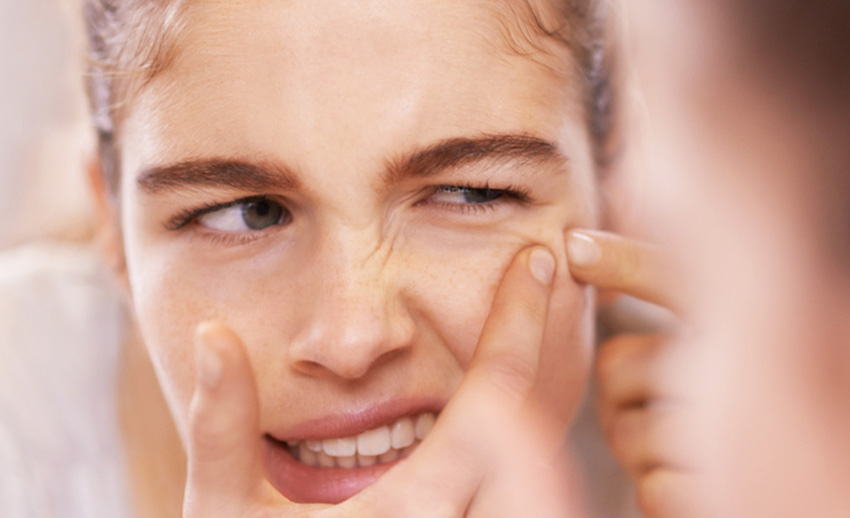 Hamilikte Sivilce Sorunu Neden Olur?