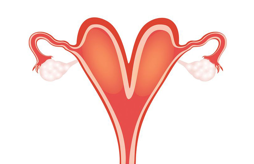 Kalp Şeklinde Rahim (Arkuat Uterus) Nedir? Zararı Ne?