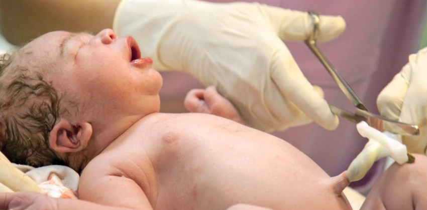 Kordon Kanı Hakkında Yanlış Bilinen 6 Bilgi