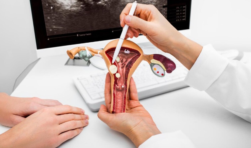 Rahimdeki Polipler Hamileliğe Engel mi?