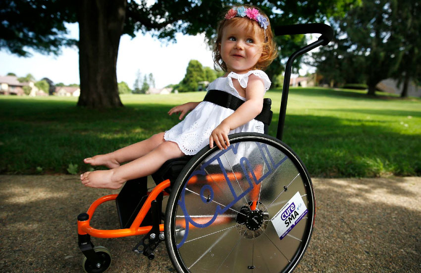 SMA Hastalığı Nedir? Belirtileri ve Tedavisi Nasıldır?