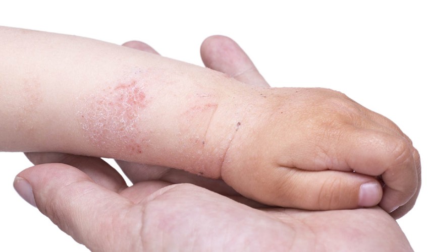 Temre Nedir? Bebekler Temre Nasıl Geçer?