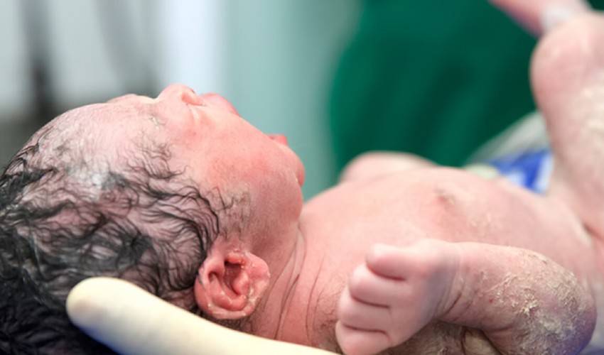 Verniks Kazeoza Nedir, Bebeğe Faydaları Nelerdir?