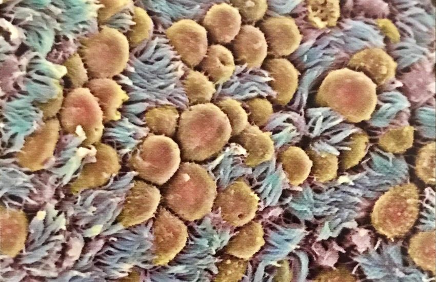 11 günlük gebelik foto