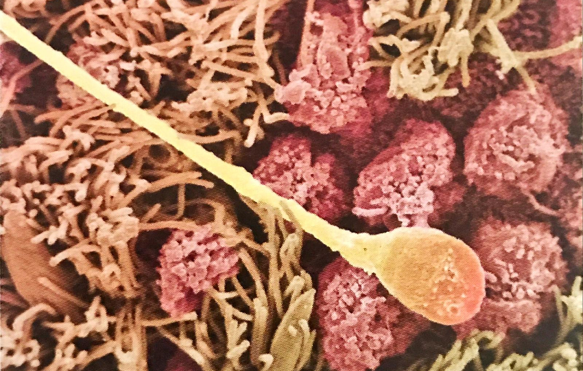 13_gunluk_hamilelik_foto