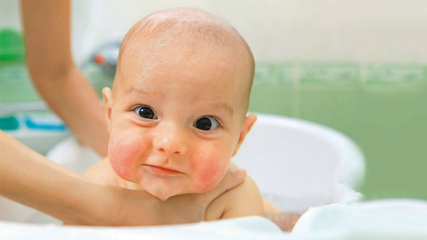 Çocuklarda akut dönemde atopik dermatit tedavisi Çocuklarda akut dönemde atopik dermatit tedavisi