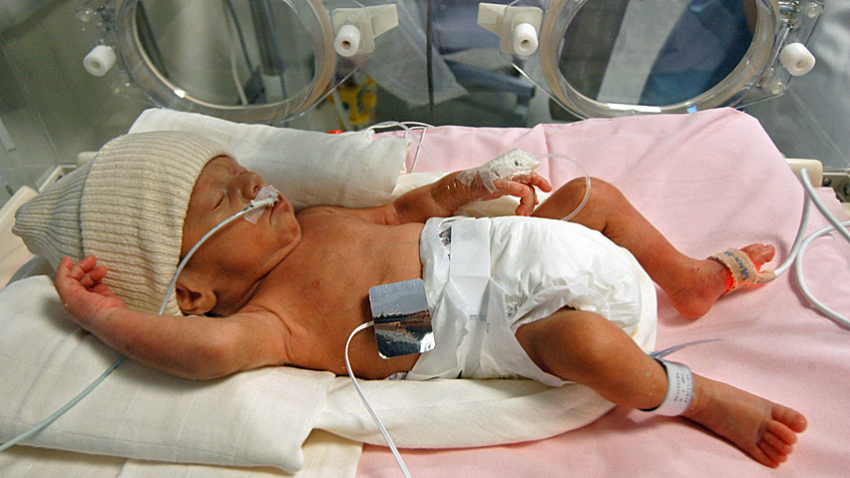 prematüre bebeklerde beslenme