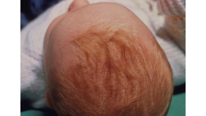 bebek kafasında konak