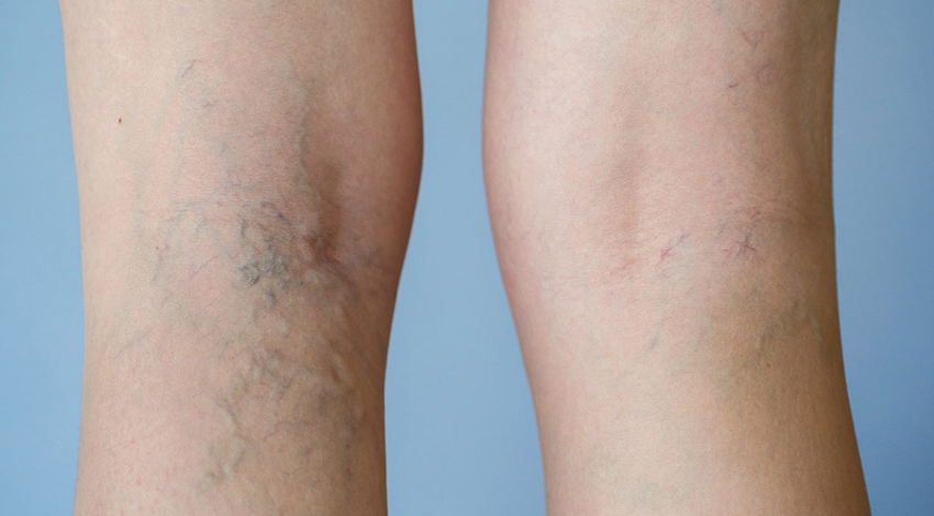 doğum sonrası vücut nasıl toparlanır