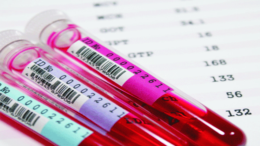 progesteron testi progesteron hormonu testi