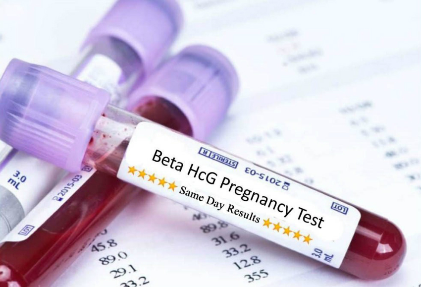 beta hcg testi