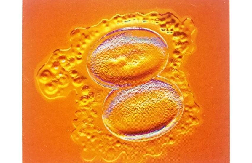 17 günlük hamilelik