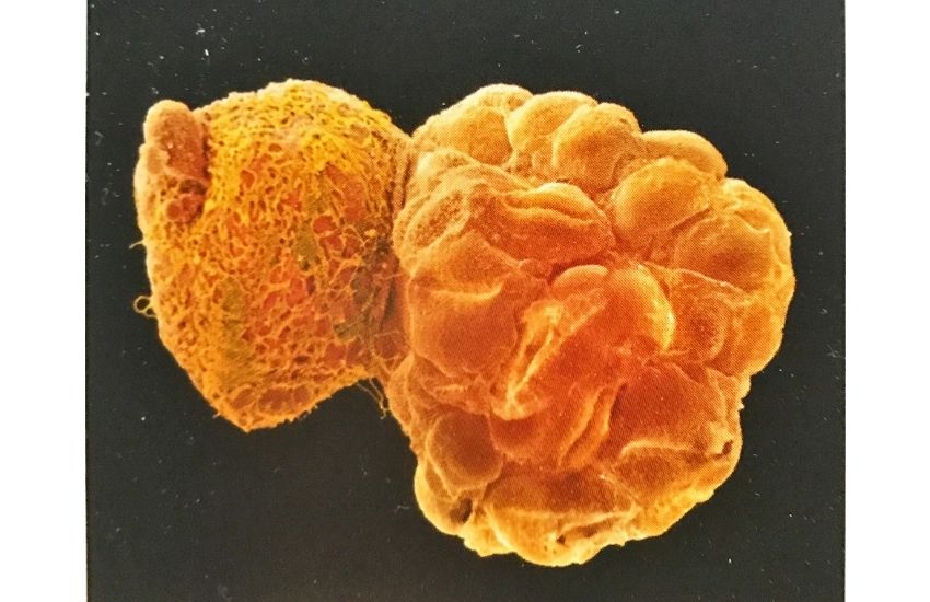 19 günlük gebelik foto