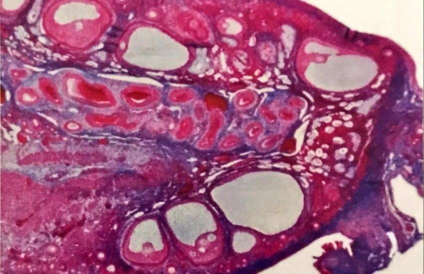 2 günlük gebelik foto