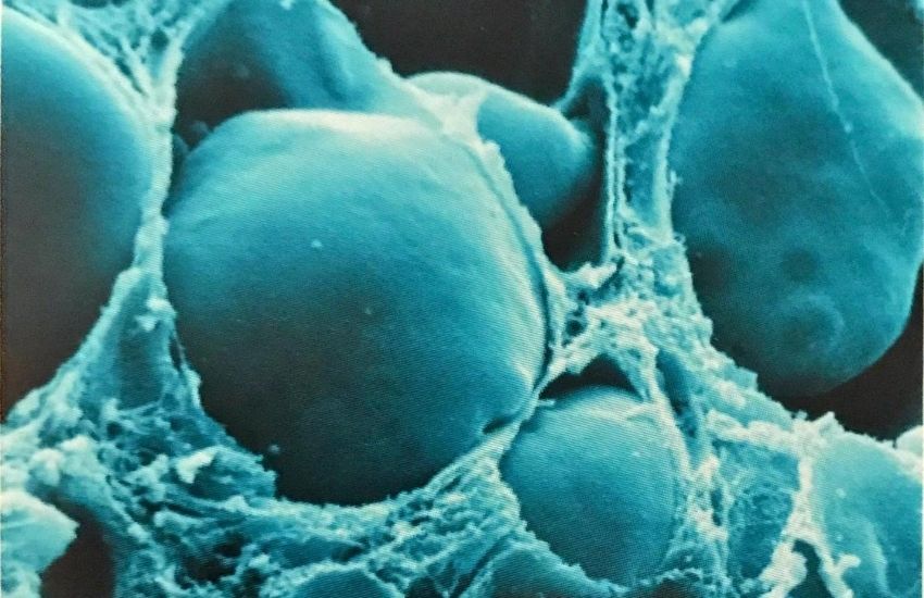 5 günlük hamilelik foto