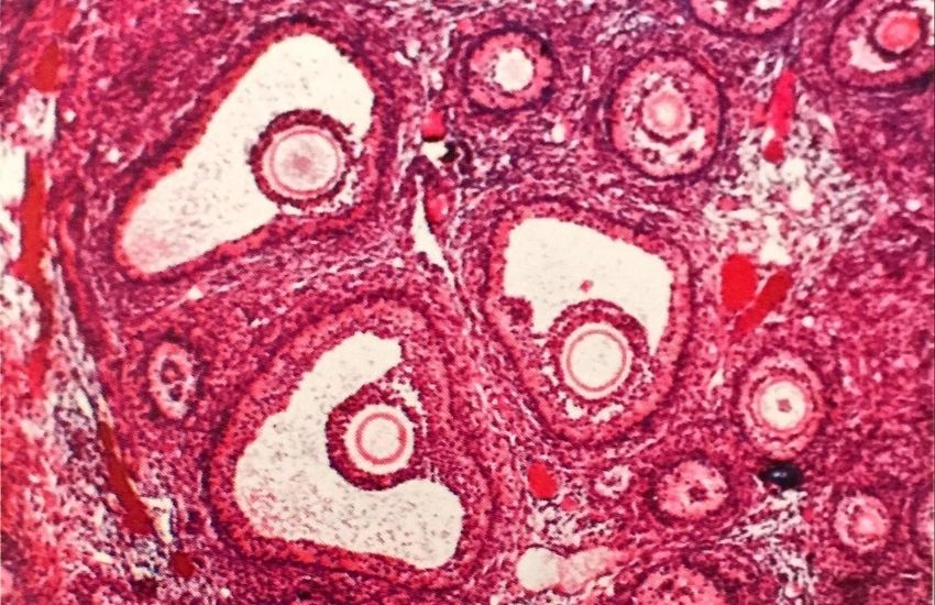 8 günlük gebelik foto