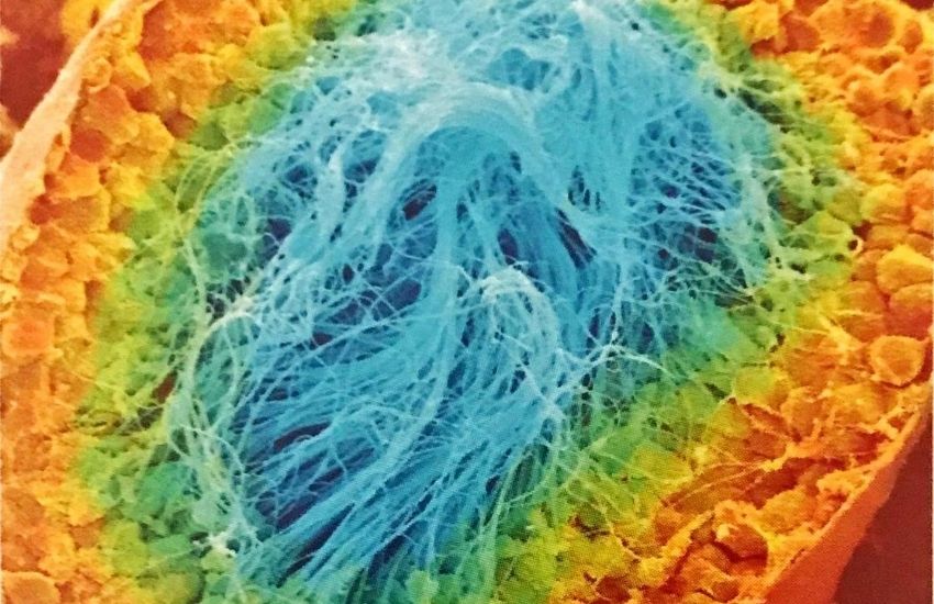 9 günlük hamilelik foto