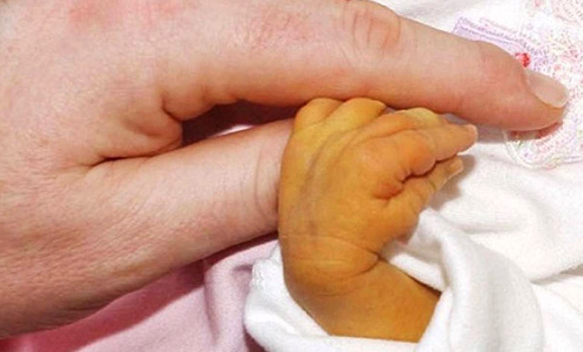 Bebeklerde sarılık derecesi Bebeklerde sarılık derecesi kaç olmalı