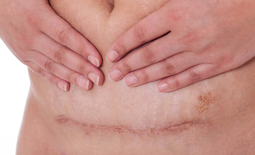 doğum sonrası kaşıntı