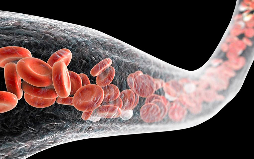 hamilelikte demir eksikligi