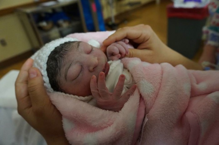 Nöral tüp defekti nedenleri