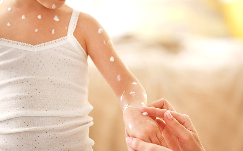 pire ısırığı kaşıntısı pire ısırığı nasıl geçer