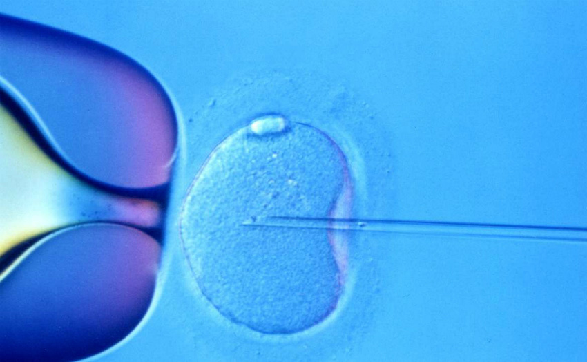 tüp bebek aşamaları tüp bebek nasıl olur