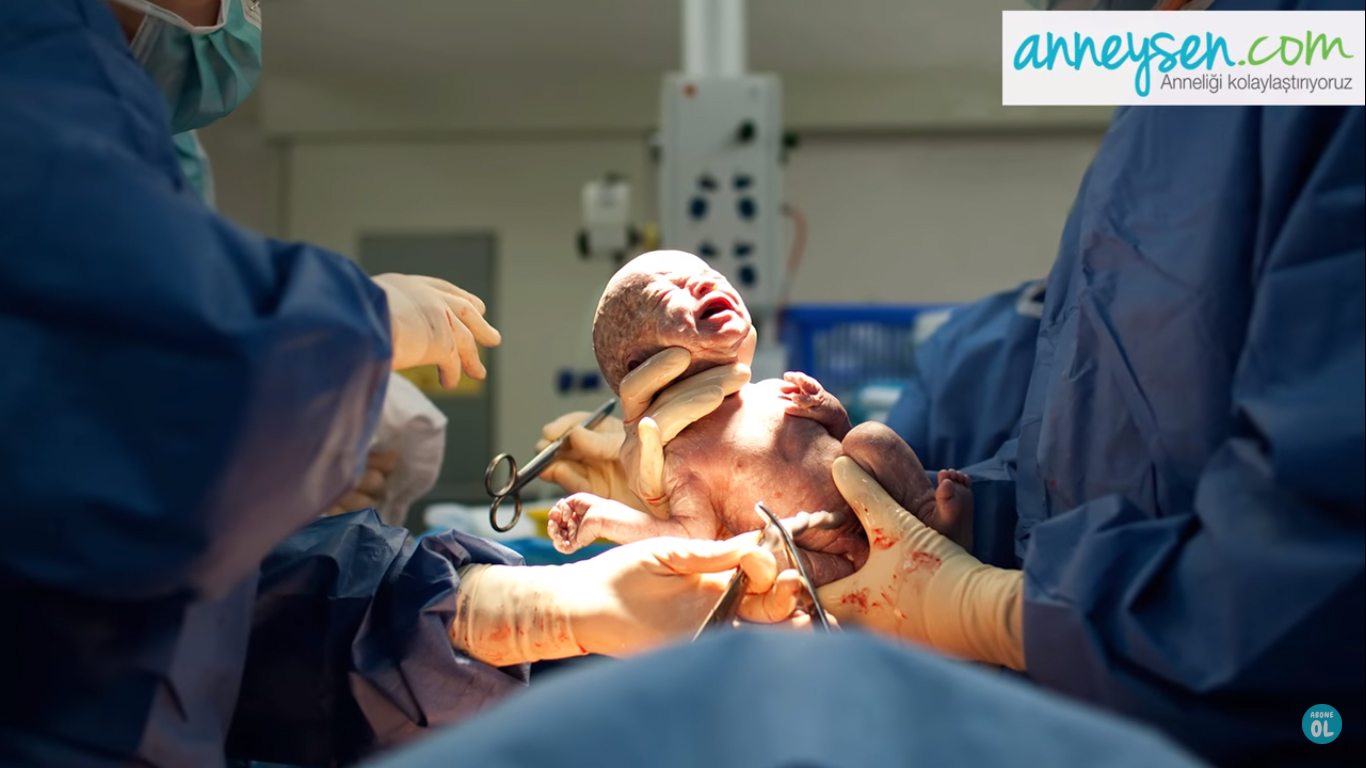 Sezaryen Doğumun Gerekli Olduğu Koşullar Nelerdir?