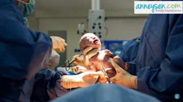 Sezaryen Doğumun Gerekli Olduğu Koşullar Nelerdir?